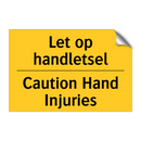 Let op handletsel - Caution Hand Injuries & Let op handletsel - Caution Hand Injuries