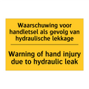 Waarschuwing voor handletsel als /.../ - Warning of hand injury due to /.../