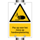 Pas op voor het risico op handverplettering