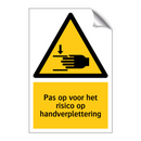 Pas op voor het risico op handverplettering