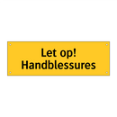 Let op! Handblessures & Let op! Handblessures & Let op! Handblessures & Let op! Handblessures