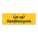 Let op! Handblessures & Let op! Handblessures & Let op! Handblessures